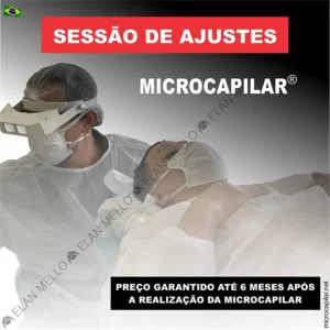 Sessão de Ajustes de Microcapilar® - Por até 6 pague só os custos qu serviço